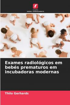Exames radiológicos em bebés prematuros em incubadoras modernas