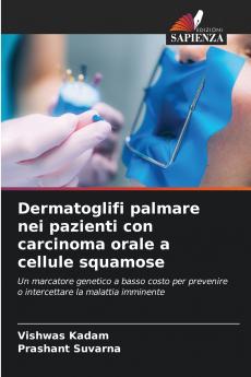 Dermatoglifi palmare nei pazienti con carcinoma orale a cellule squamose