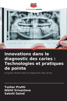 Innovations dans le diagnostic des caries