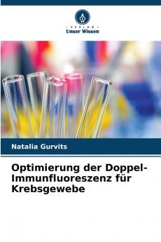 Optimierung der Doppel-Immunfluoreszenz für Krebsgewebe
