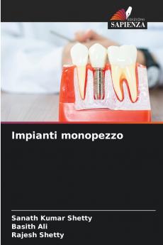Impianti monopezzo