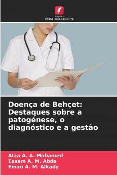 Doença de Behçet