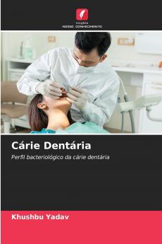 Cárie Dentária