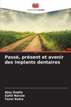 Passé présent et avenir des implants dentaires
