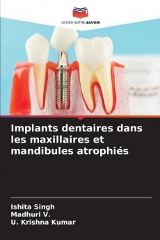Implants dentaires dans les maxillaires et mandibules atrophiés