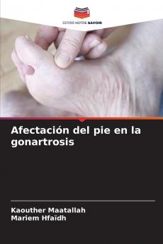 Afectación del pie en la gonartrosis