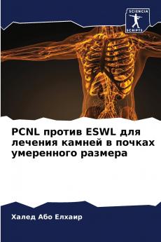 PCNL ?????? ESWL ??? ??????? ?????? ? ?????? ?????????? ???????