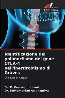 Identificazione del polimorfismo del gene CTLA-4 nell'ipertiroidismo di Graves