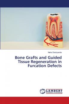 Bone Grafts and Guided Tissue Regeneration in Furcation Defects