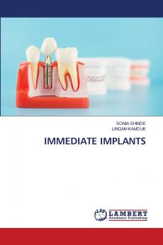 IMMEDIATE IMPLANTS