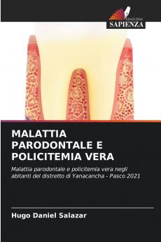 MALATTIA PARODONTALE E POLICITEMIA VERA