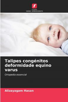 Talipes congénitos deformidade equino varus