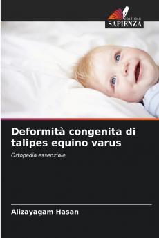 Deformità congenita di talipes equino varus