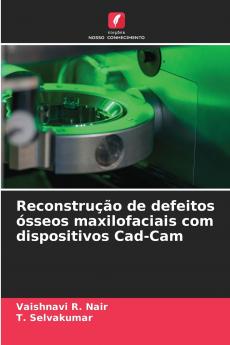 Reconstrução de defeitos ósseos maxilofaciais com dispositivos Cad-Cam