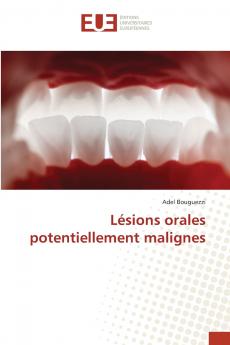 Lésions orales potentiellement malignes