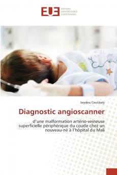 Diagnostic angioscanner