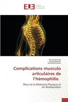 Complications musculo articulaires de l'h��mophilie