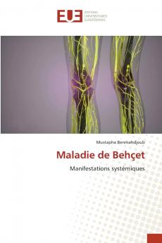 Maladie de Behçet