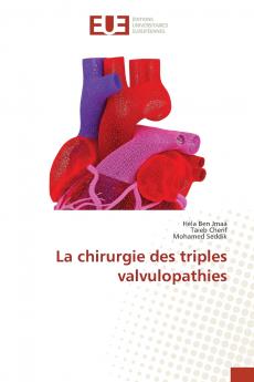 La chirurgie des triples valvulopathies