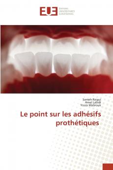 Le point sur les adhésifs prothétiques