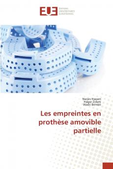 Les empreintes en prothèse amovible partielle