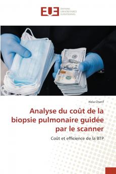 Analyse du coût de la biopsie pulmonaire guidée par le scanner