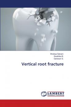 Vertical root fracture