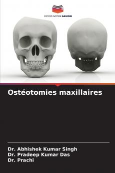 Ostéotomies maxillaires