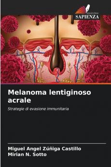 Melanoma lentiginoso acrale