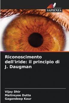 Riconoscimento dell'iride