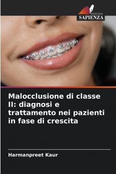Malocclusione di classe II