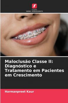 Maloclusão Classe II