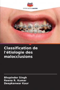 Classification de l'étiologie des malocclusions