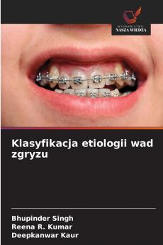 Klasyfikacja etiologii wad zgryzu