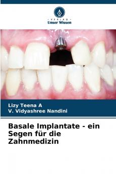 Basale Implantate - ein Segen für die Zahnmedizin