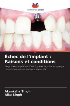 Échec de l'implant