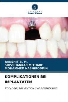KOMPLIKATIONEN BEI IMPLANTATEN