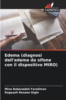 Edema (diagnosi dell'edema da sifone con il dispositivo MIRO)