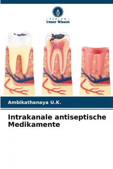 Intrakanale antiseptische Medikamente