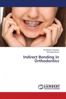 Indirect Bonding in Orthodontics