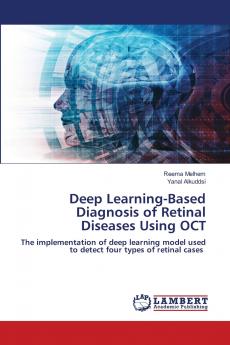 Deep Learning-Based Diagnosis of Retinal Diseases Using OCT