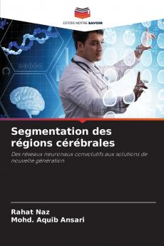 Segmentation des régions cérébrales