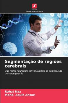 Segmentação de regiões cerebrais