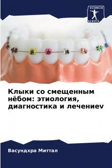 ????? ?? ????????? ?????