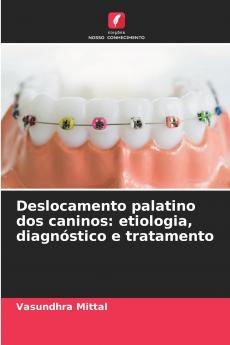 Deslocamento palatino dos caninos