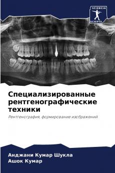 ?????????????????? ??????????????????? ???????