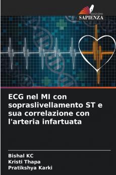 ECG nel MI con sopraslivellamento ST e sua correlazione con l'arteria infartuata