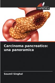Carcinoma pancreatico