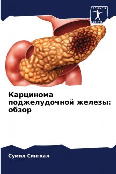 ????????? ????????????? ??????