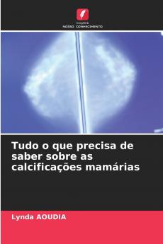 Tudo o que precisa de saber sobre as calcificações mamárias